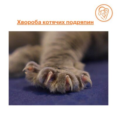 Хвороба КП